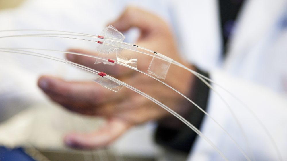 I framtiden kanske laserljus kan stråla bort cancertumörer. Laserljuset leds i sådana här optiska fiber, vilka sticks in i patientens hud. Fotograf: Charlotte Carlberg Bärg